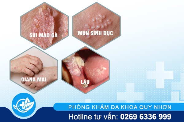 bieu-hien-benh-xa-hoi-3