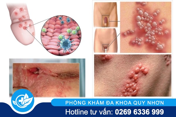 mun-do-vung-kin-nam-nu