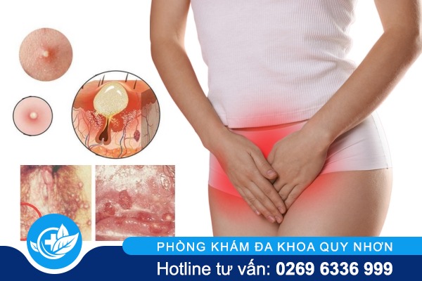 noi-mun-trang-am-dao