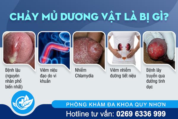 chay-mu-duong-vat-la-bi-gi