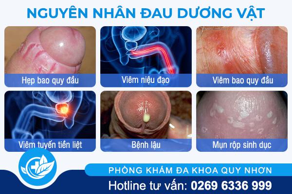 nguyen-nhan-dau-duong-vat