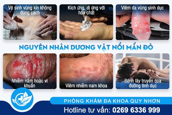 nguyen-nhan-duong-vat-noi-man-do