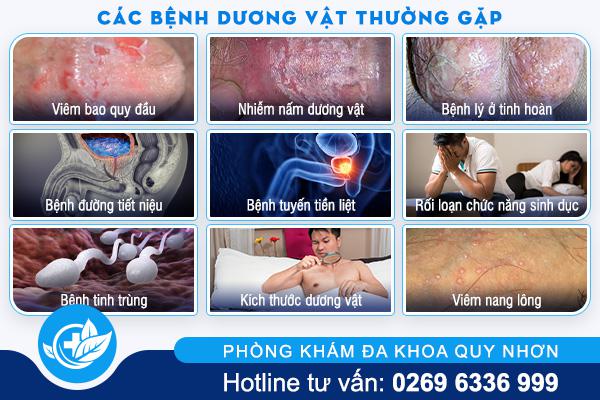cac-benh-duong-vat-thuong-gap