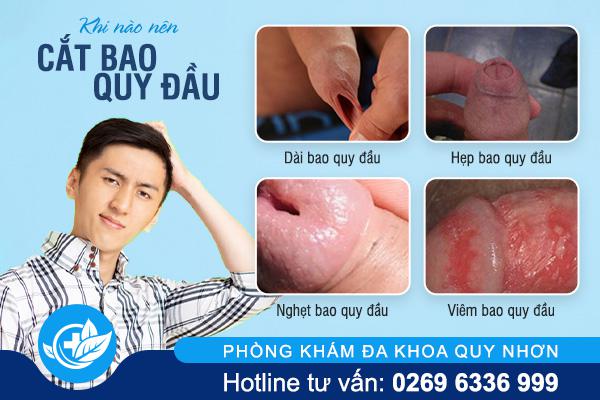 cat-bao-quy-dau-tham-my-an-toan-chi-phi-binh-dan-1