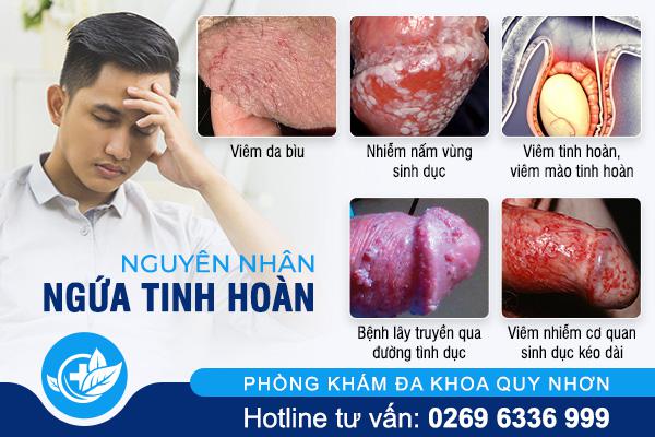 nguyen-nhan-ngua-tinh-hoan