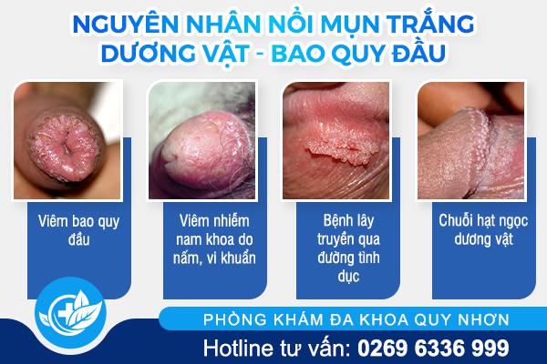 nguyen-nhan-noi-mun-trang-duong-vat-bao-quy-dau