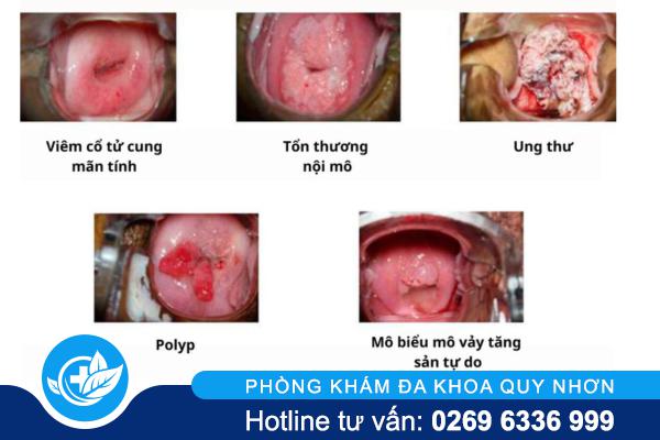 bien-chung-benh-lau (2)