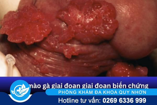 bien-chung-sui-mao-ga (1)