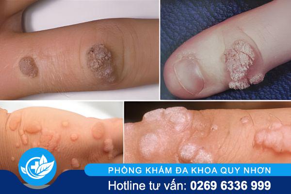 bien-chung-sui-mao-ga