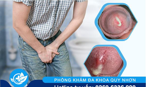 duong-vat-bi-dau-va-chay-mu