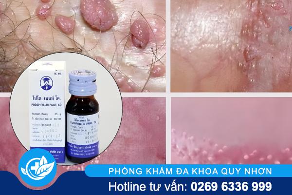 thuoc-chua-sui-mao-ga (1)