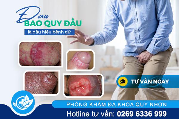 dau-bao-quy-dau-la-dau-hieu-cua-benh-gi