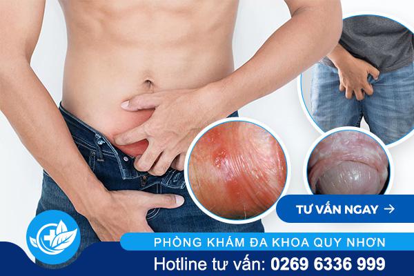 ngua-bao-quy-dau (1)