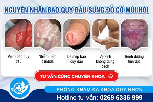 nguyen-nhan-bao-quy-dau-sung-do-co-mui-hoi