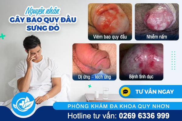 nguyen-nhan-gay-bao-quy-dau-sung-do