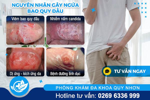 nguyen-nhan-gay-ngua-bao-quy-dau (1)