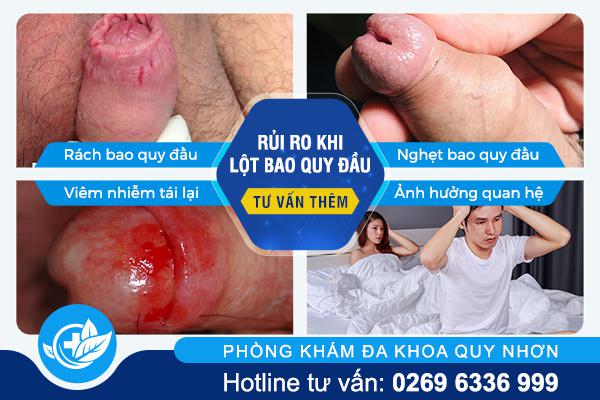 rui-ro-khi-tu-lot-bao-quy-dau