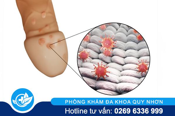 sui-mao-ga-duong-vat (1)