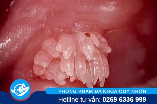 sui-mao-ga-duong-vat (2)