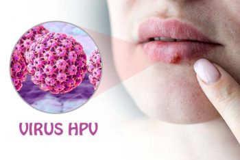 Chữa sùi mào gà ở miệng bằng phương pháp nào hiệu quả?