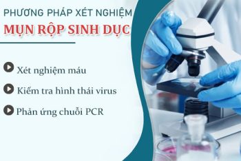Xét nghiệm mụn rộp sinh dục ở đâu uy tín?