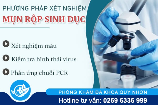 Xét nghiệm mụn rộp sinh dục ở đâu uy tín?