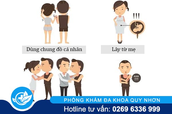 Bệnh mồng gà là gì có nguy hiểm không?