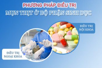 Mụn thịt ở bộ phận sinh dục là bị bệnh gì?