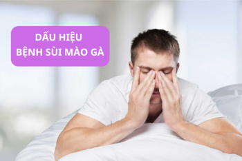 4 Biện pháp chữa sùi mào gà đến từ Quy Nhơn