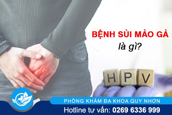 Sùi mào gà có lây không và qua đường nào?