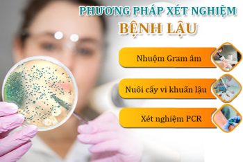 Bạn đã nắm rõ về nguyên nhân bệnh lậu chưa?