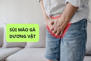 Những thông tin quan trọng về sùi mào gà dương vật 