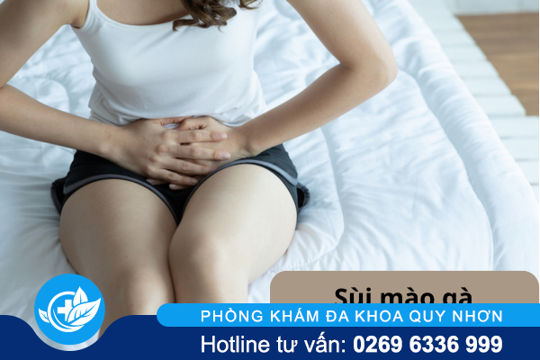 Thông tin về sùi mào gà ở môi lớn và môi bé