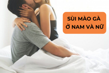 Tổng Hợp Sùi Mào Gà