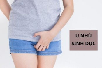 Những điều chưa biết về u nhú sinh dục