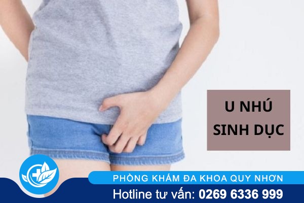 Những điều chưa biết về u nhú sinh dục