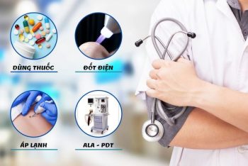 Đâu là biện pháp trị sùi mào gà tốt nhất hiện nay?