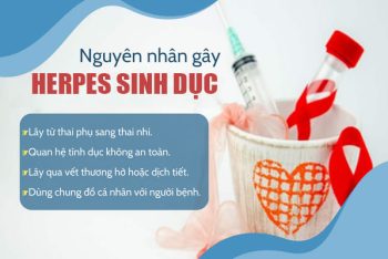 Điểm danh các nguyên nhân mụn rộp sinh dục