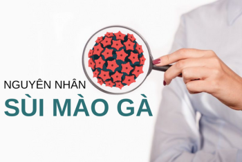 3+ Nguyên nhân sùi mào gà không ngờ đến 