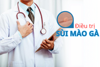 Biện pháp nào điều trị sùi mào gà tối ưu?