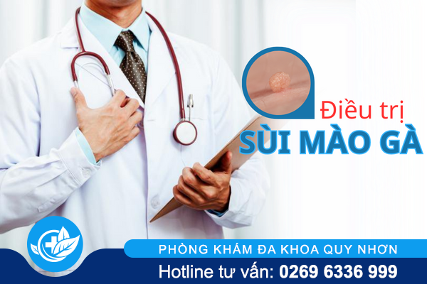 Biện pháp nào điều trị sùi mào gà tối ưu?