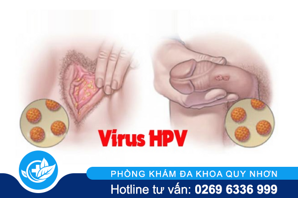 bien-phap-nao-dieu-tri-sui-mao-ga-toi-uu-1