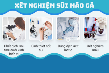 Các biện pháp xét nghiệm sùi mào gà chính xác