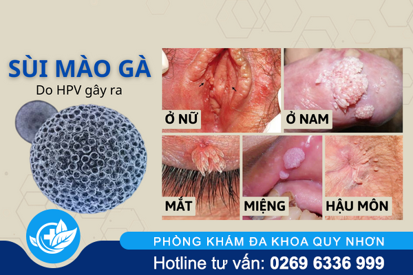 dia-chi-chua-sui-mao-ga-tot-nhat-tai-tp-da-nang-1