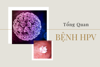 Những thông tin tổng quan bệnh HPV cần biết