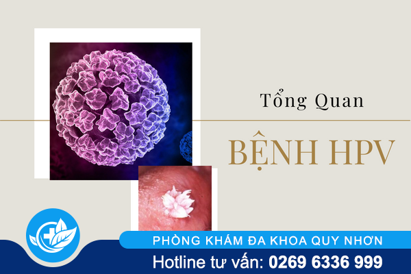 Những thông tin tổng quan bệnh HPV cần biết