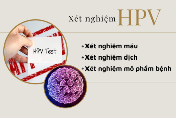 Xét nghiệm HPV như thế nào và ở đâu chính xác?