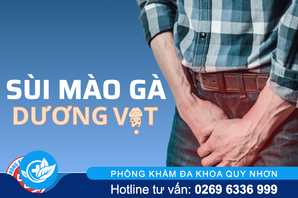 Sùi mào gà dương vật khó nói nên đầy nguy hiểm