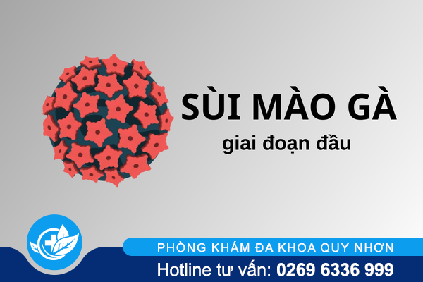 Sùi mào gà giai đoạn đầu – Phát hiện sớm dễ điều trị