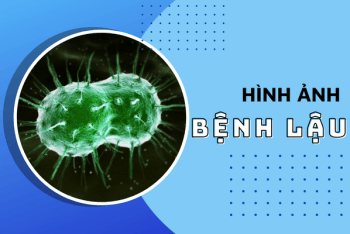 Tổng hợp hình ảnh bệnh lậu qua từng giai đoạn